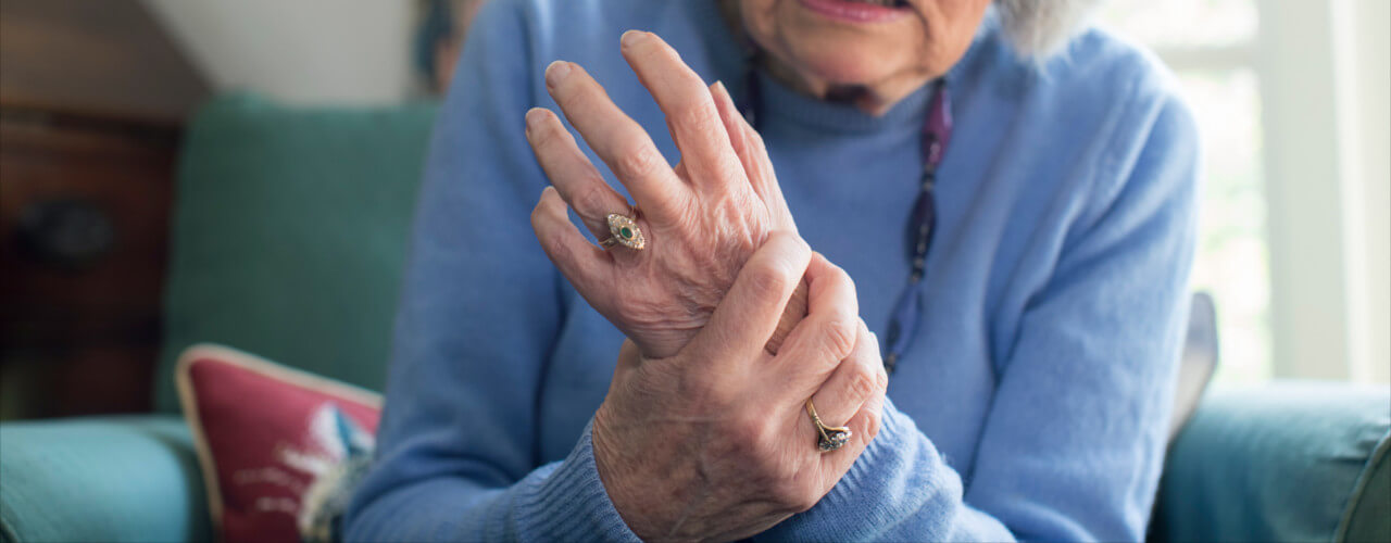 Arthritis – Dealing with Rheumatoid Arthritis