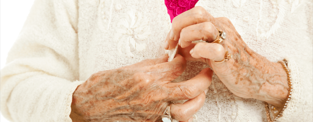 Arthritis and How Physical Therapy helps Springfield, PA